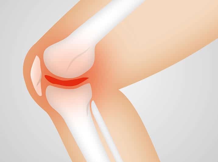 Best Knee Pain Relief Products: Natural Remedies that Work