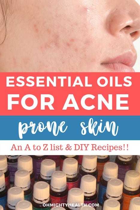 The A to Z of Essential Oils for Acne Prone Skin