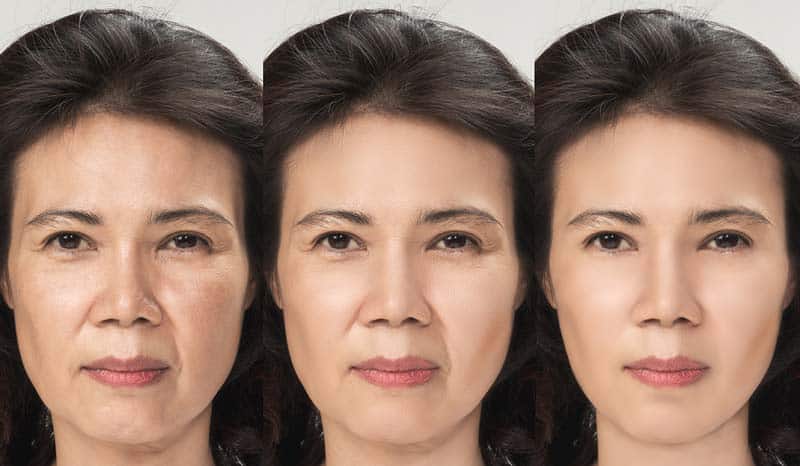 Skin aging process (3 images)
