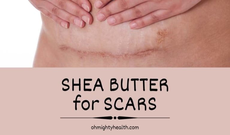 Shea Butter for Scars: How to Heal a Scar