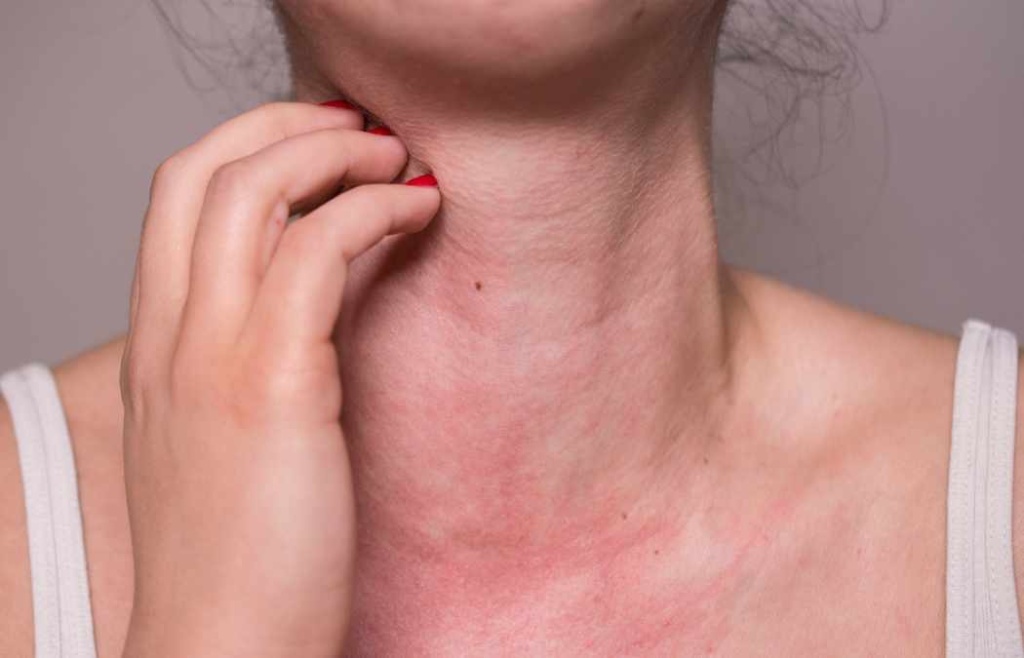 skin allergy