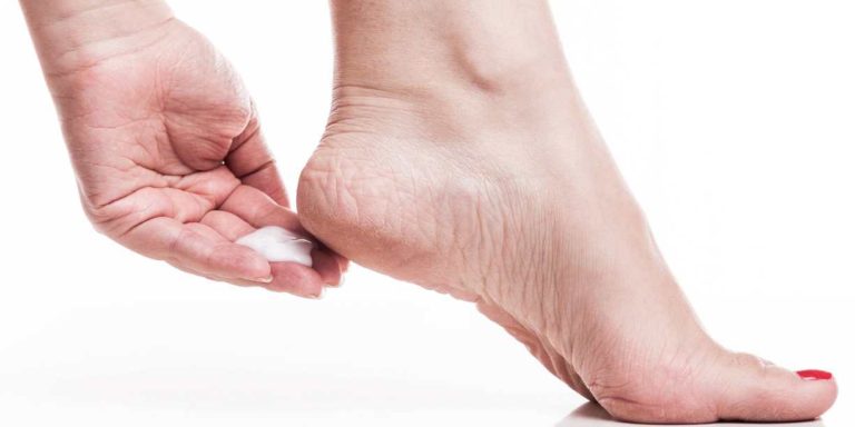 Shea Butter for Cracked Heels: Natural Remedy Guide