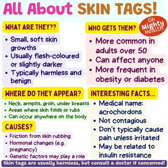 All about skin tags.