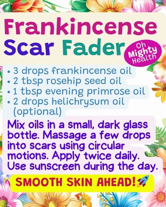 Frankincense oil recipes 4: scar fading diy recipe.