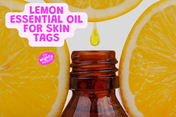 Lemon essential oil for skin tags.