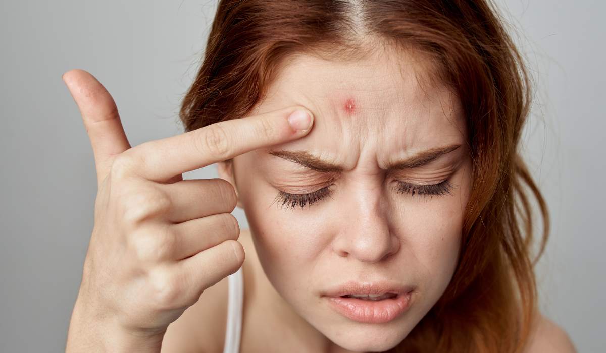 Deep pimple.
